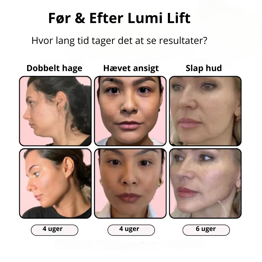 Lumi