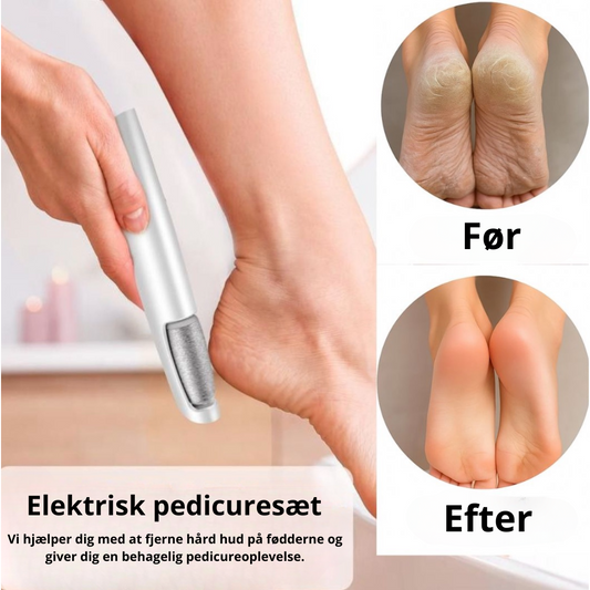 BlissVælger – Fra sprukne hæle til silkebløde fødder